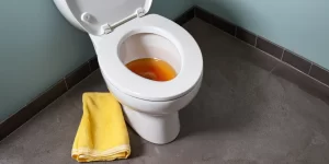 Hard Water Stain Remover for Toilet: Say Goodbye to Mineral Buildup